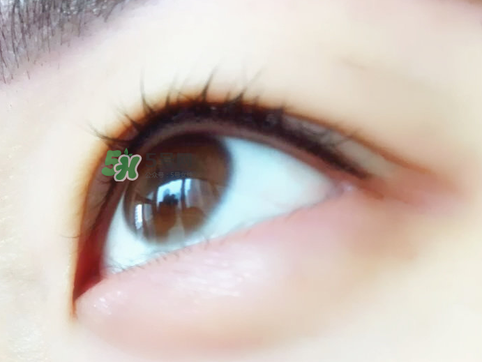 做美瞳線麻藥進眼睛怎么辦？做美瞳線麻藥灼傷眼睛怎么辦？