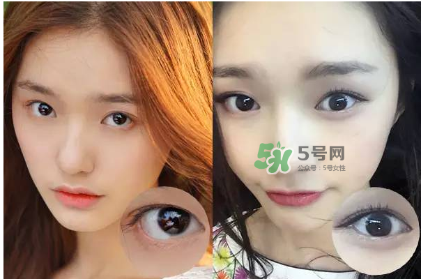 做美瞳線會(huì)不會(huì)掉睫毛？做美瞳線掉睫毛怎么辦？