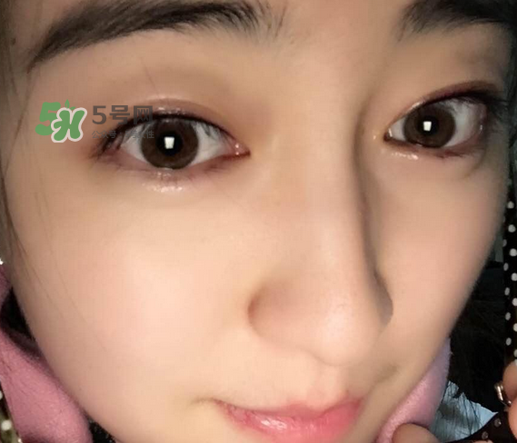 做美瞳線可以喝酒嗎？做美瞳線喝酒有影響嗎？