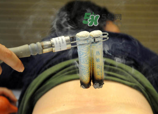 三伏天艾灸后能吹空調(diào)嗎？三伏天艾灸后能吹電扇嗎？