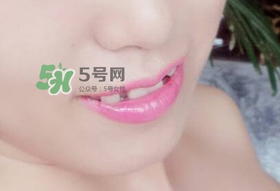 牙齒縫隙大怎么辦？牙縫大帶牙套有用嗎