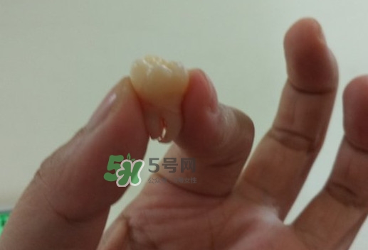 拔智齒痛嗎？智齒拔了多久洞會好？