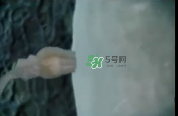 懷孕初期怎么保胎？陰道出血是流產(chǎn)征兆嗎？