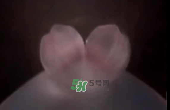 懷孕初期怎么保胎？陰道出血是流產(chǎn)征兆嗎？