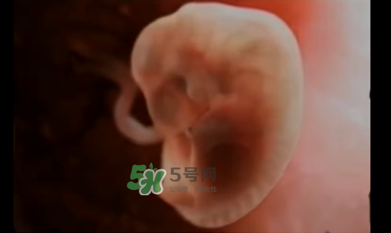 懷孕初期怎么保胎？陰道出血是流產(chǎn)征兆嗎？