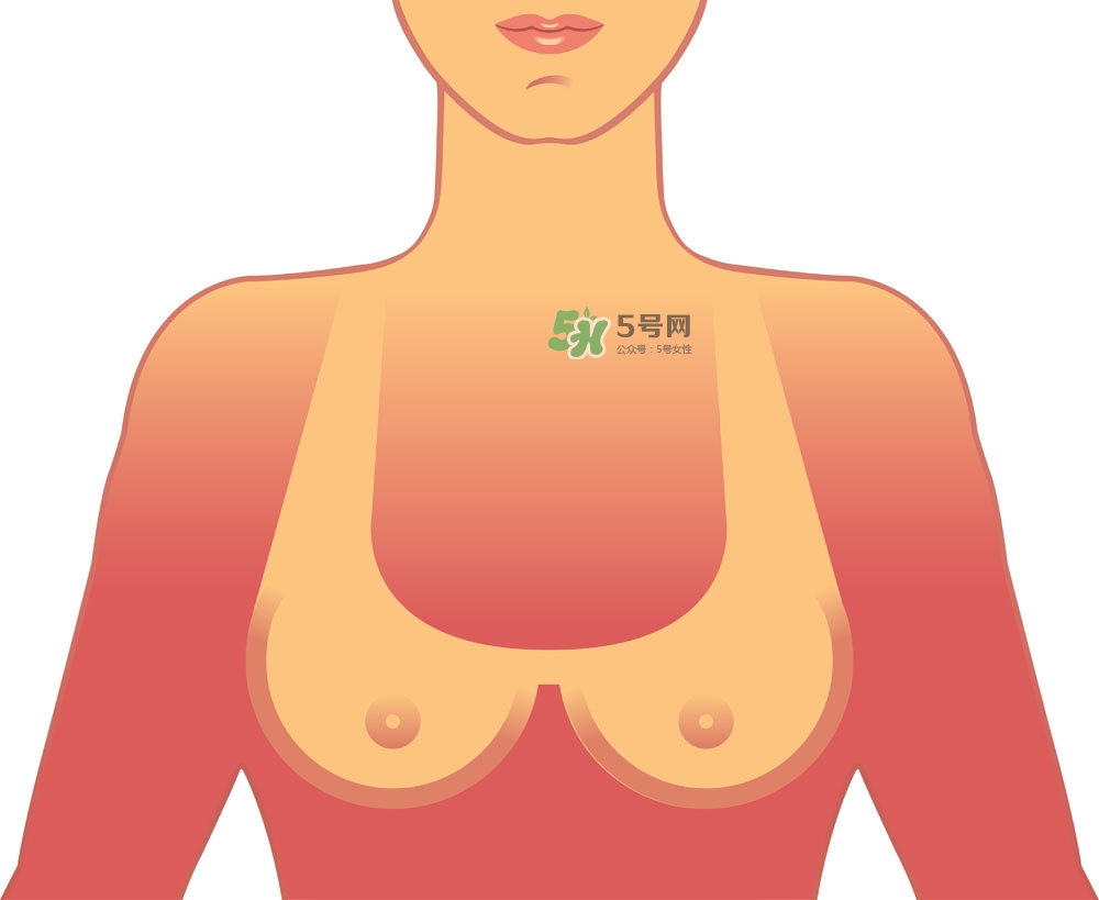 女性乳頭癢是怎么回事？女性乳頭癢要怎么治療？