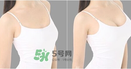 女性乳頭癢是怎么回事？女性乳頭癢要怎么治療？