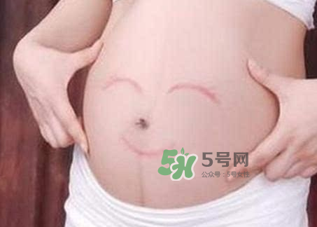 產(chǎn)婦胃脹氣怎么緩解？產(chǎn)婦胃脹氣怎么辦？