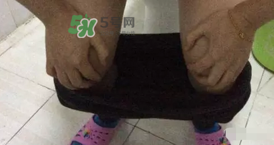 孕期可以蹲著上廁所嗎？孕期上廁所會(huì)壓到寶寶嗎？
