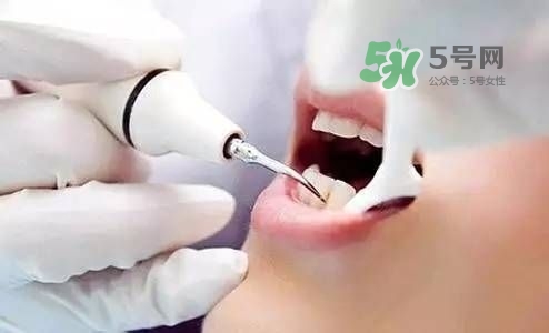 孕婦能矯正牙齒嗎？懷孕期間可以矯正牙齒嗎？