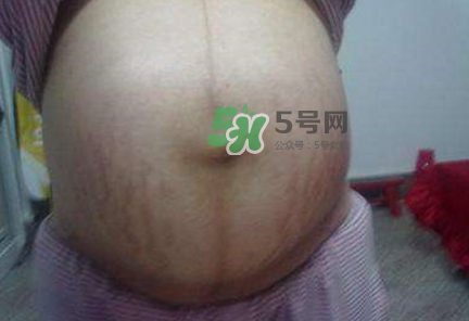 懷女孩肚子上會長毛嗎？懷女孩肚子特征圖片