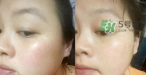 可思美潔面儀好不好用？可思美凈致潔顏聲波潔面儀怎么樣？