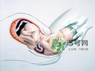 順產(chǎn)和剖腹產(chǎn)哪個(gè)好？順產(chǎn)和剖腹產(chǎn)哪個(gè)痛？