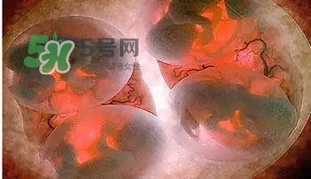 多胞胎是怎么生產(chǎn)的？多胞胎應(yīng)選擇什么分娩方式