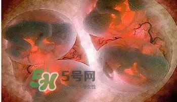多胞胎順產(chǎn)怎么生？多胞胎剖腹產(chǎn)和單胎剖腹產(chǎn)的區(qū)別