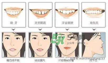 乳牙齲齒要不要補？乳牙齲齒怎么辦？