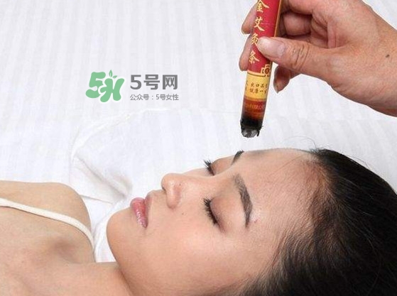 艾灸會(huì)不會(huì)過敏？艾灸過敏怎么辦