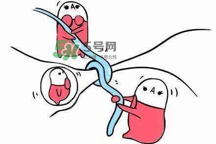 結扎好還是上環(huán)好？結扎上環(huán)哪個危害??？
