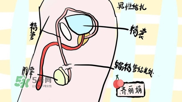 生完二胎一定要結(jié)扎嗎？生完二胎結(jié)扎好不好？
