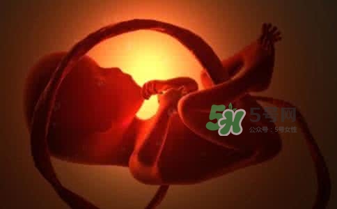 寶寶臍帶繞頸只能剖腹產(chǎn)嗎？胎兒臍帶繞頸孕婦有什么感覺