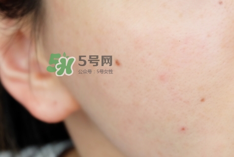 臘梅是什么牌子？臘梅是什么護膚品