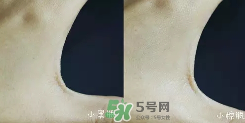 小黑瓶和小棕瓶可以一起用嗎？小棕瓶和小黑瓶哪個先用