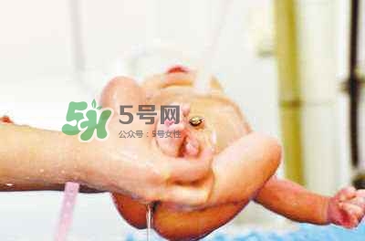羊水栓塞是醫(yī)療事故嗎？羊水栓塞多發(fā)生于順產(chǎn)還是剖腹產(chǎn)？