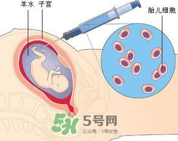 羊水栓塞是怎么回事？羊水栓塞怎么預(yù)防？