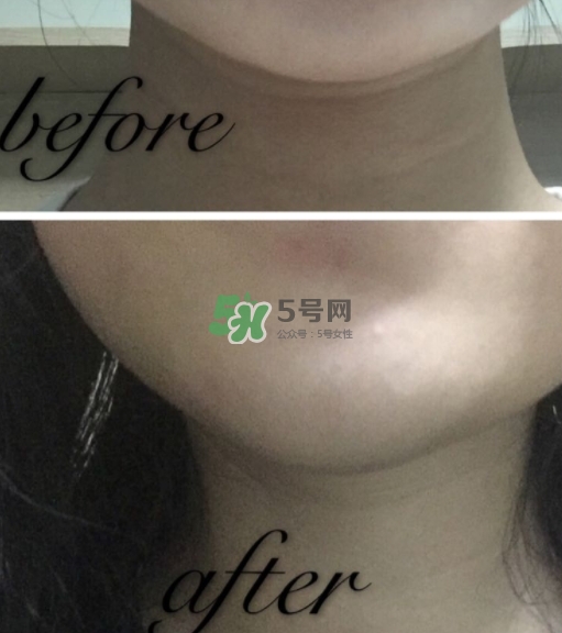 olay小白瓶有哪些版本？olay小白瓶版本區(qū)別