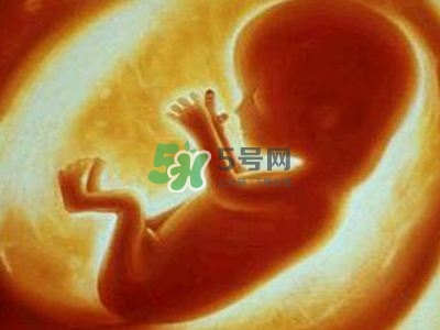 臍帶繞頸是什么原因造成的？臍帶繞頸是多休息還是多運動？