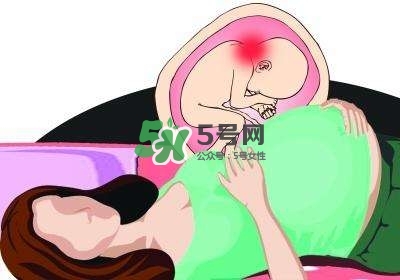孕婦左側臥睡不著怎么辦？孕期左側睡不舒服怎么辦？