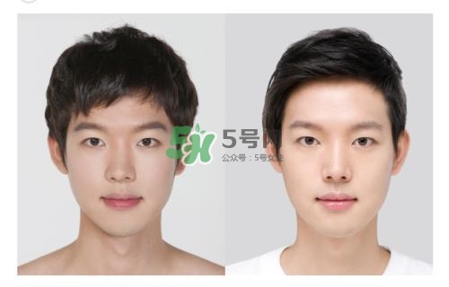 美白針有副作用嗎？美白針有什么副作用？