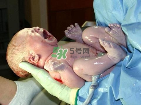順產(chǎn)有多疼？順產(chǎn)的疼痛可以忍受嗎？