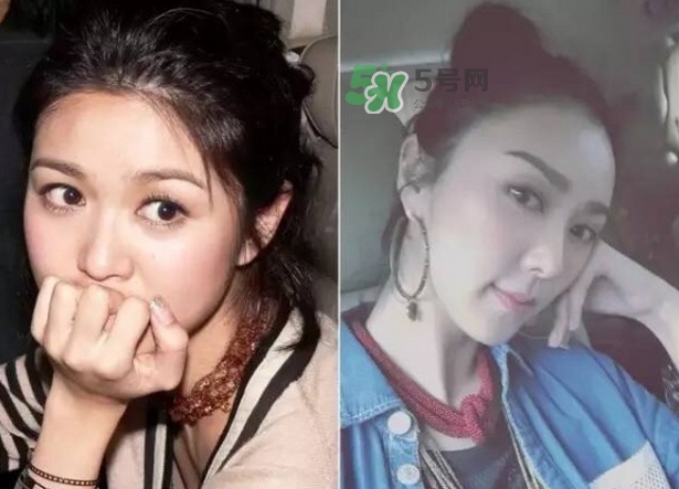 發(fā)際線低怎么調(diào)整？標(biāo)準(zhǔn)的發(fā)際線圖片