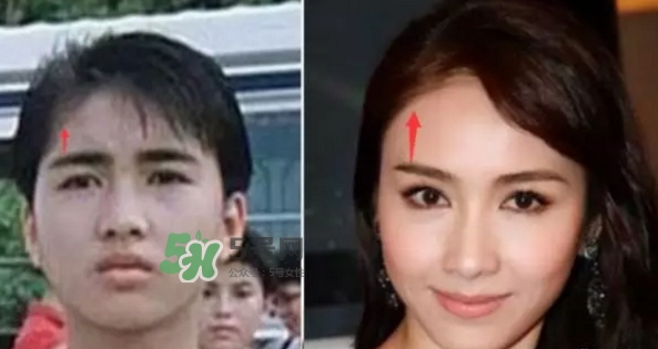 發(fā)際線低怎么調(diào)整？標(biāo)準(zhǔn)的發(fā)際線圖片