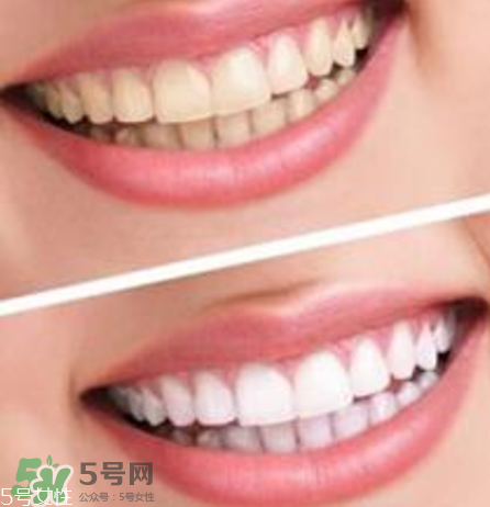 碧緹福美牙儀對(duì)牙齒有傷害嗎？碧緹福美牙儀會(huì)反彈嗎？