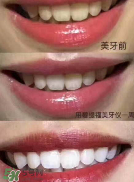 美牙儀能用水洗嗎？美牙儀能用多久？