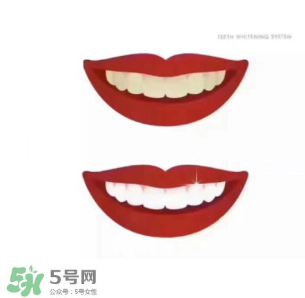 美牙儀能帶上飛機(jī)嗎？美牙儀可以過安檢嗎？