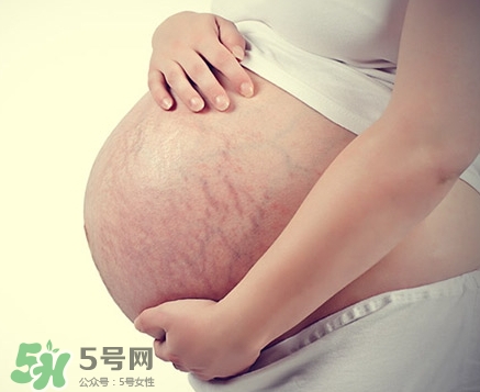 孕婦胸部長(zhǎng)妊娠紋嗎？胸部長(zhǎng)妊娠紋了怎么辦？