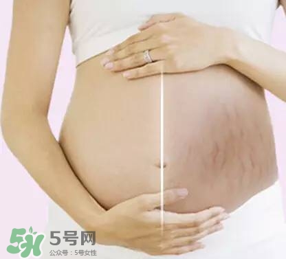 長妊娠紋的前兆 長妊娠紋很癢怎么辦？