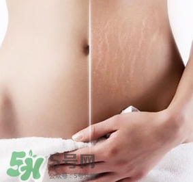 妊娠紋什么時(shí)候變白？妊娠紋產(chǎn)品什么時(shí)候用？