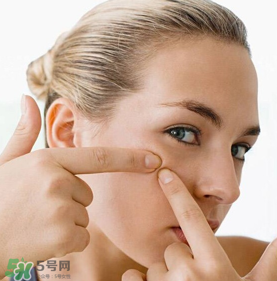 長痘長閉口怎么辦？長痘長閉口是什么原因？