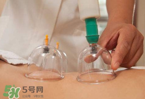真空拔罐有用嗎？真空拔罐多長(zhǎng)時(shí)間合適