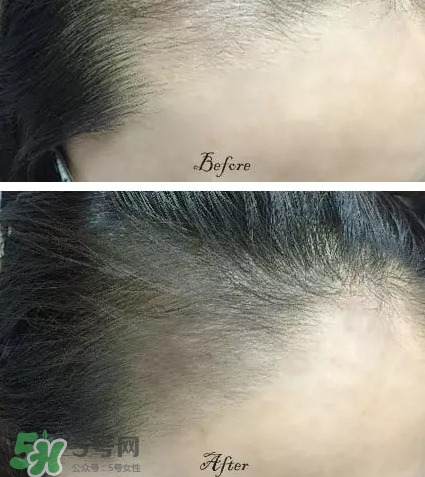 發(fā)際線粉要卸妝嗎_怎么卸？