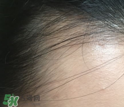 發(fā)際線粉要卸妝嗎_怎么卸？