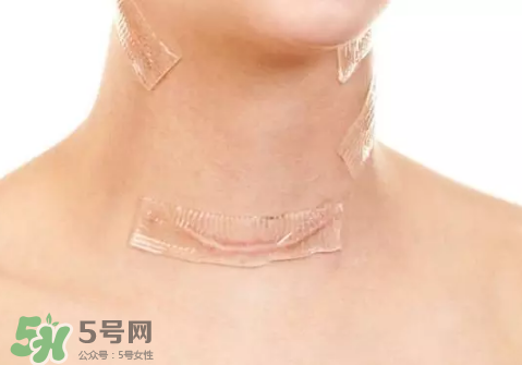 硅膠疤痕貼有用嗎？硅膠疤痕貼效果怎么樣？