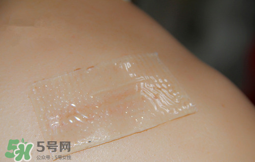 仙卡疤痕貼有用嗎？仙卡疤痕貼效果怎么樣？