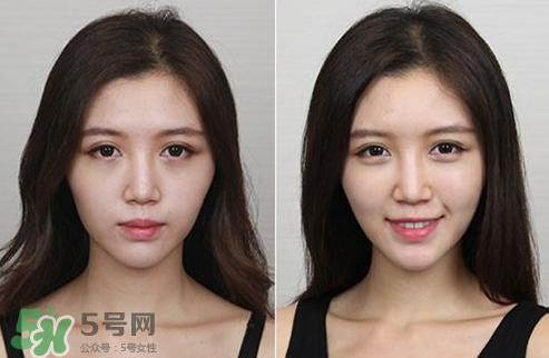 蘋果肌怎么化？蘋果肌究竟哪里好？