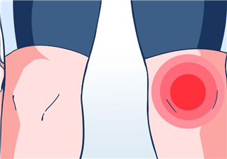 風(fēng)濕可以泡腳嗎？風(fēng)濕可以泡溫泉嗎？