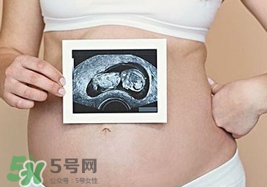 雙子宮可以上環(huán)嗎？雙子宮上環(huán)要注意哪些？
